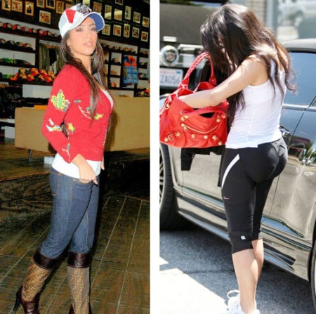  Kardashian    Surgery on Kim Kardashian    Kim Kardashian Plastic Surgery Before After